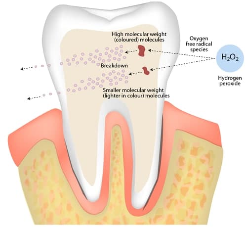 teeth whitening science